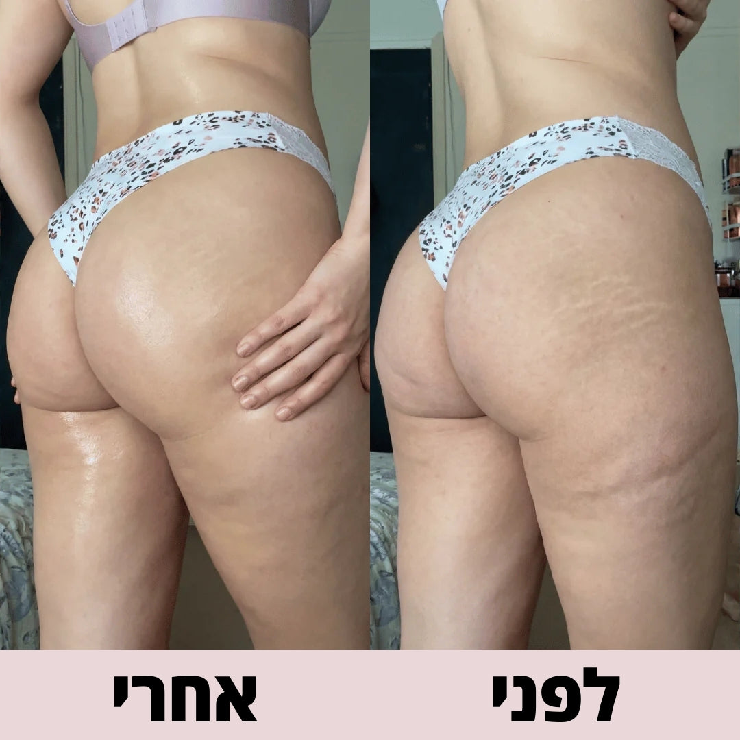 שמן עיסוי לשיפור מראה הצלוליט, מיצוק ועיצוב הגוף